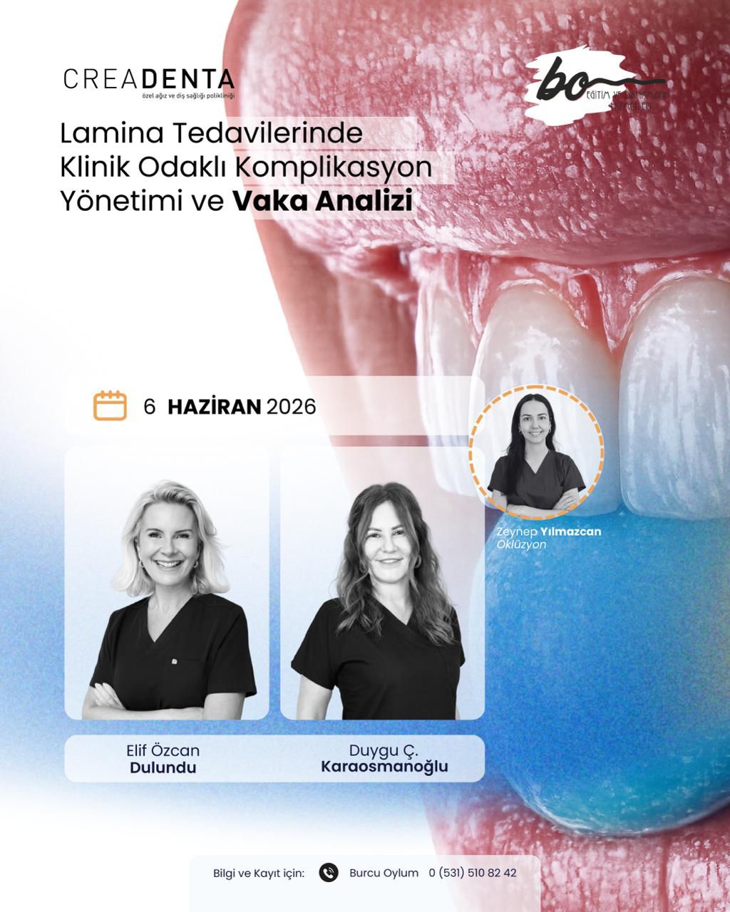 Lamina Tedavilerinde Klinik Odaklı Komplikasyon Yönetimi ve Vaka Analizi